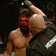 Illustration for article titled Mike Perrys Nose Was Thoroughly Fucked Up By A Knee